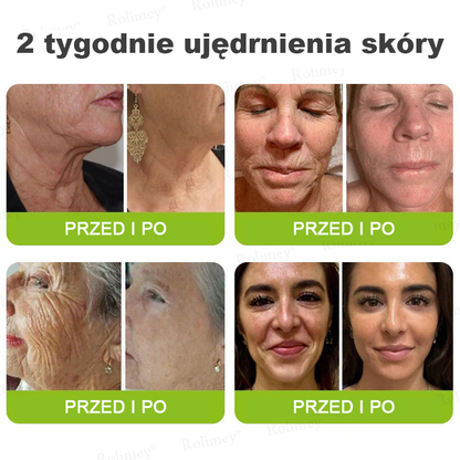 🎁Rolimey® krem przeciwzmarszczkowy (z peptydami typu Botox i Vita-A Retinol) – ostatni dzień promocji, 70% TANIEJ ⏰