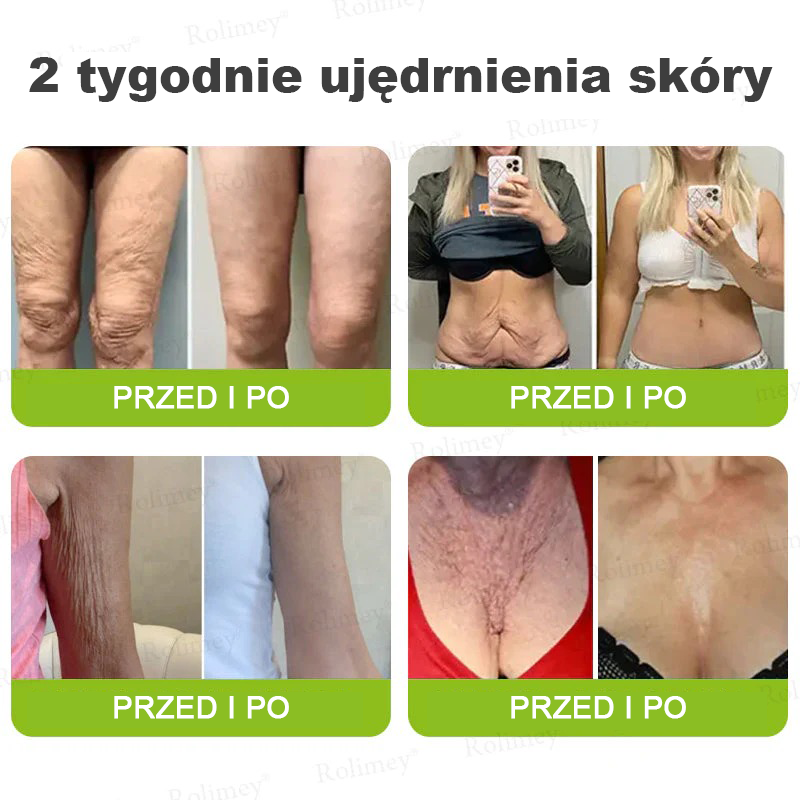 🎁Rolimey® krem przeciwzmarszczkowy (z peptydami typu Botox i Vita-A Retinol) – ostatni dzień promocji, 70% TANIEJ ⏰