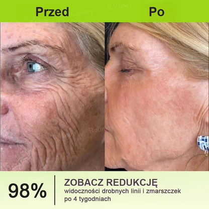🎁Rolimey® krem przeciwzmarszczkowy (z peptydami typu Botox i Vita-A Retinol) – ostatni dzień promocji, 70% TANIEJ ⏰