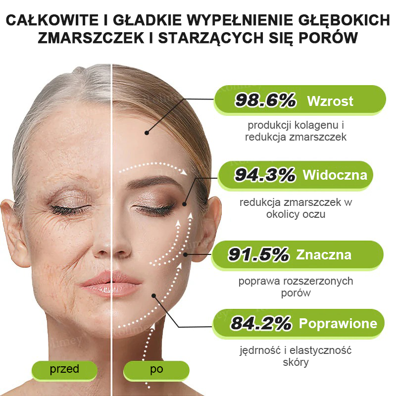 🎁Rolimey® krem przeciwzmarszczkowy (z peptydami typu Botox i Vita-A Retinol) – ostatni dzień promocji, 70% TANIEJ ⏰