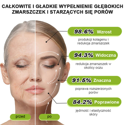 🎁Rolimey® krem przeciwzmarszczkowy (z peptydami typu Botox i Vita-A Retinol) – ostatni dzień promocji, 70% TANIEJ ⏰