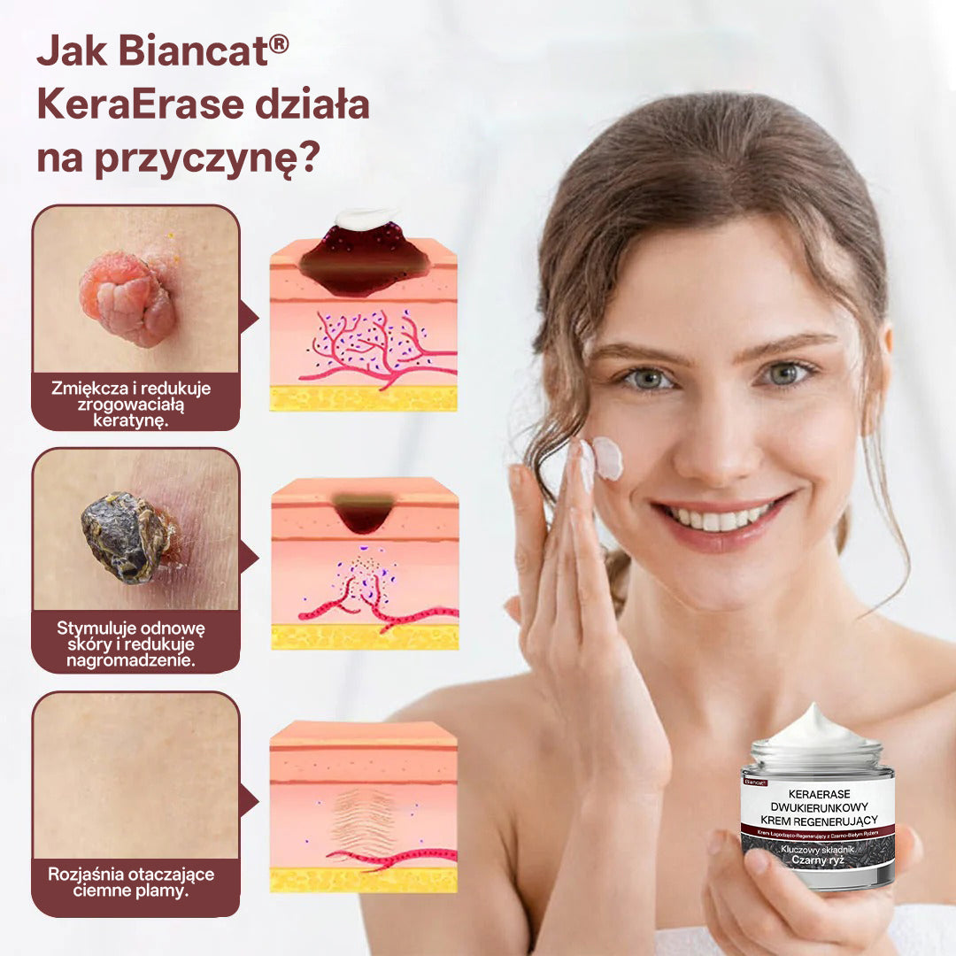 Biancat® 🌟KeraErase Dwukierunkowy Krem Regenerujący 👨‍⚕️ (do leczenia brodawek, narośli skórnych, plam oraz hiperpigmentacji)