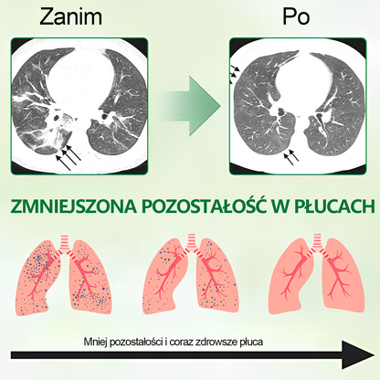 Gooyeer™ Zaawansowany spray do oczyszczania płuc✨ – zdrowe płuca, wsparcie odporności, detoksykacja i łatwiejsze oddychanie – Certyfikat CE