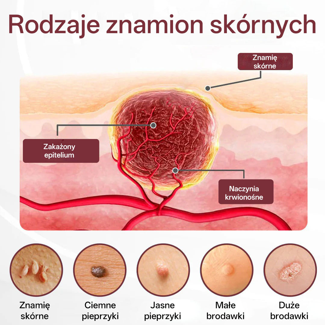 Biancat® 🌟KeraErase Dwukierunkowy Krem Regenerujący 👨‍⚕️ (do leczenia brodawek, narośli skórnych, plam oraz hiperpigmentacji)