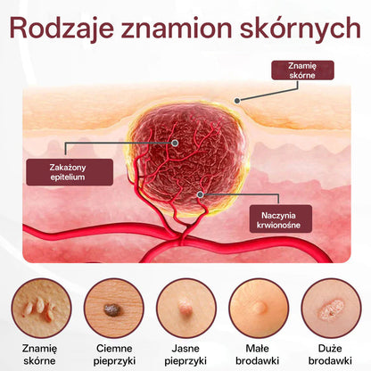 Biancat® 🌟KeraErase Dwukierunkowy Krem Regenerujący 👨‍⚕️ (do leczenia brodawek, narośli skórnych, plam oraz hiperpigmentacji)