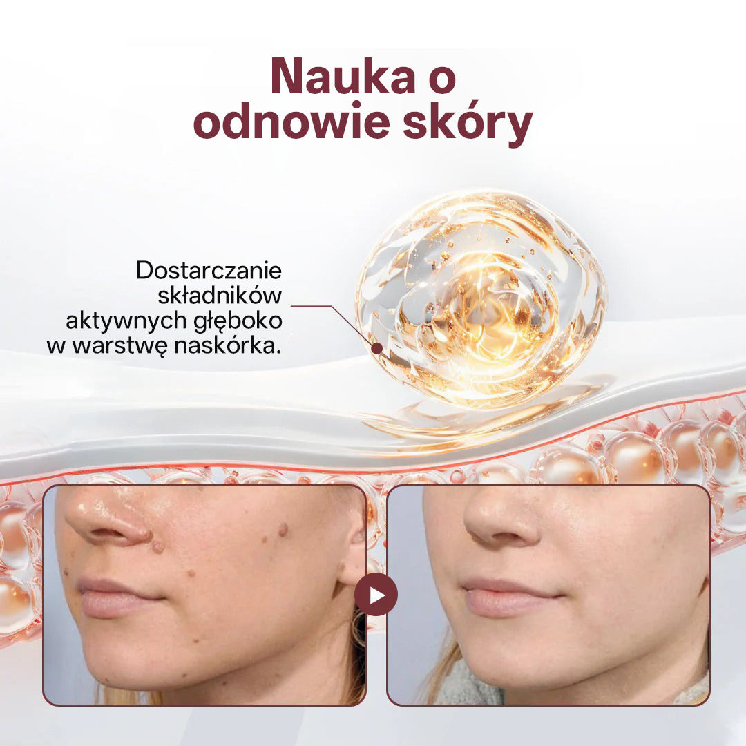 Biancat® 🌟KeraErase Dwukierunkowy Krem Regenerujący 👨‍⚕️ (do leczenia brodawek, narośli skórnych, plam oraz hiperpigmentacji)