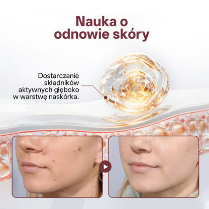 Biancat® 🌟KeraErase Dwukierunkowy Krem Regenerujący 👨‍⚕️ (do leczenia brodawek, narośli skórnych, plam oraz hiperpigmentacji)