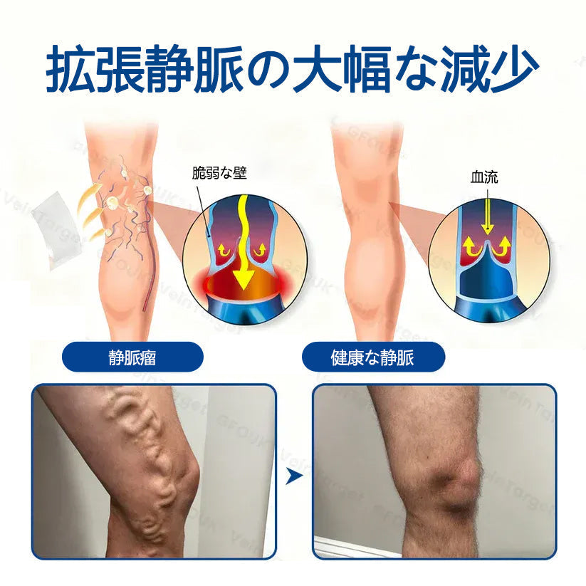 Healrize® ヴェインターゲット マイクロニードルパッチ