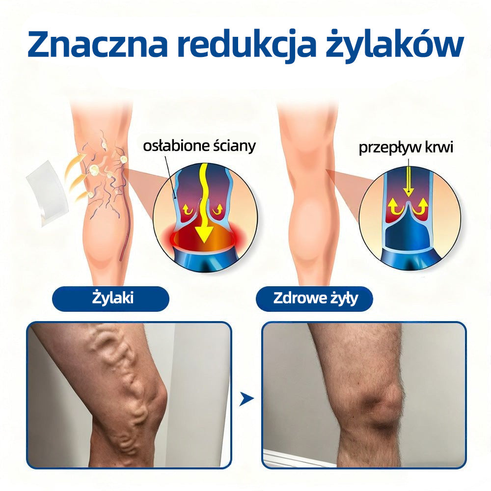 Healrize® VeinTarget Plaster z mikroigłami |⚡ Natychmiastowa ulga, długotrwałe efekty