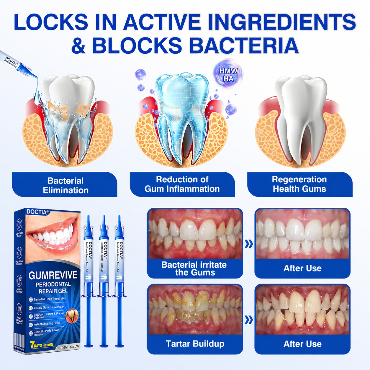 🇺🇸👨‍⚕️🦷😊 DOCTIA® GumRevive Advanced Gum Care & Repair Gel