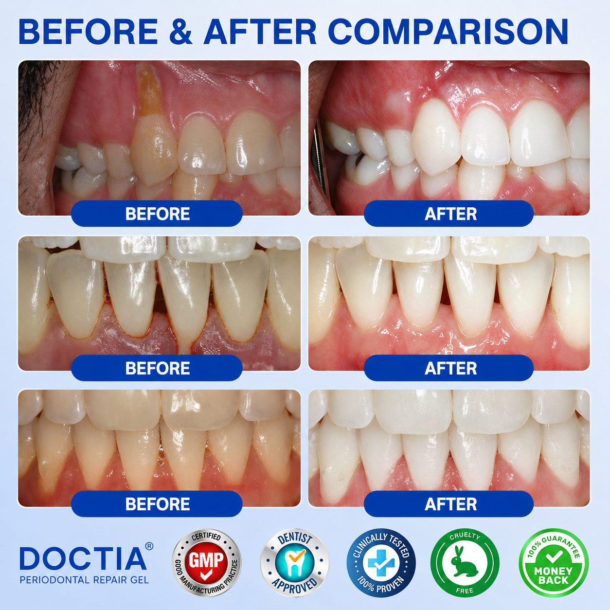 🇺🇸👨‍⚕️🦷😊 DOCTIA® GumRevive Advanced Gum Care & Repair Gel